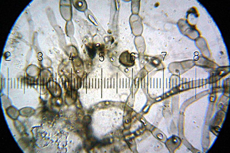 Mildew, growing on a wooden soap holder.
  100× objective, 15× eyepiece; numbered ticks are 11 µM apart.

  The full-sized version of this image is scaled such 